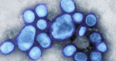 فيروس أنفلونزا الخنازير - أرشيفية