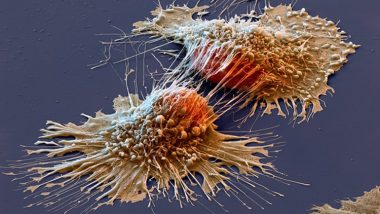 انشطار الخلية السرطانية