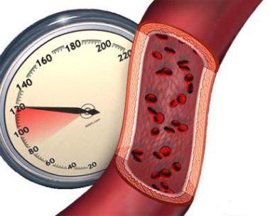 خبراء: ضغط الدم "الطبيعي" خطر على الصحة